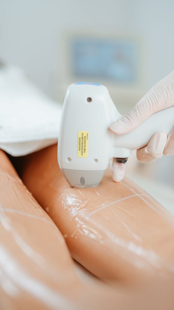 pexels photo 36930734 Close-up of laser hair removal treatment in a beauty clinic focusing on smooth legs.